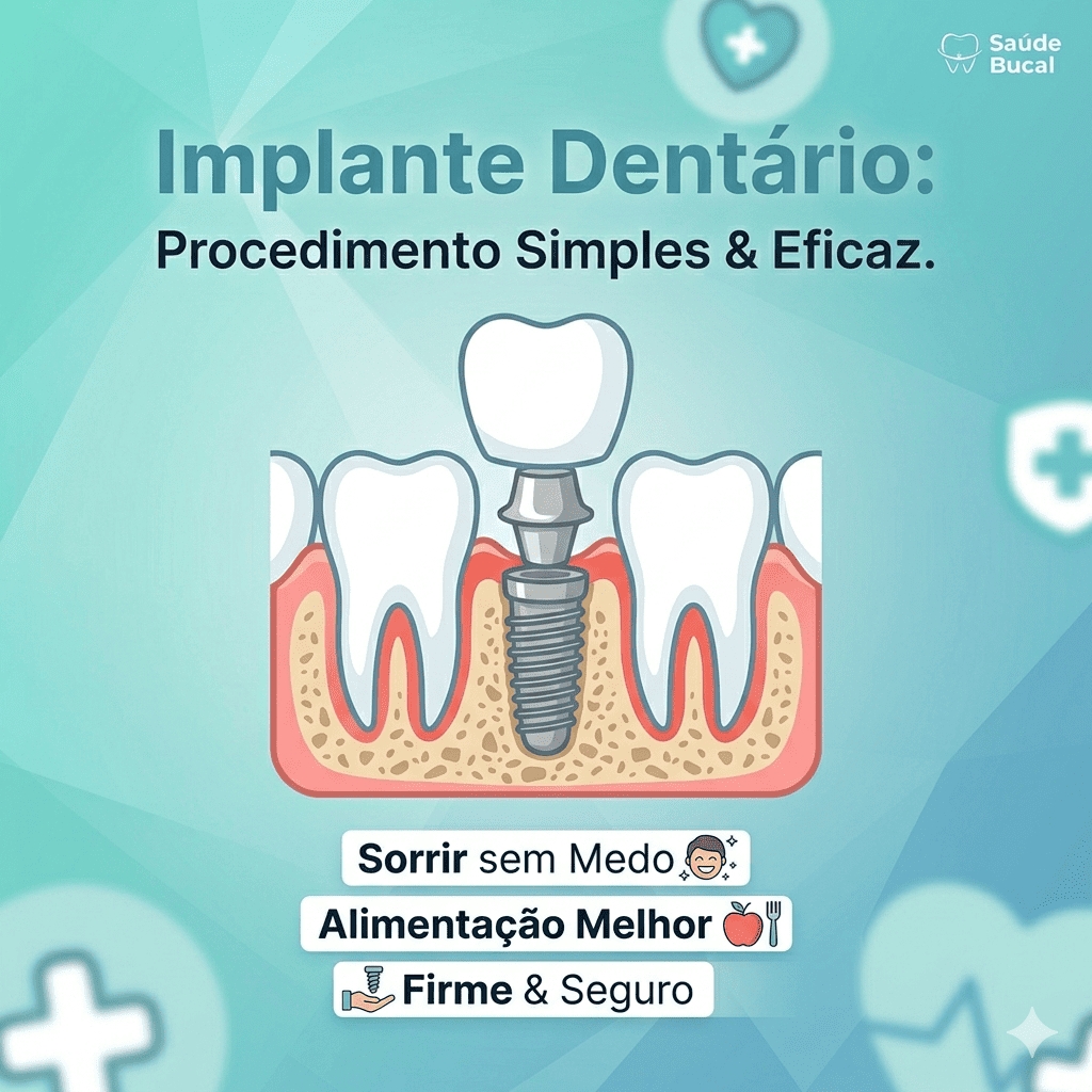 implante dentário (1)